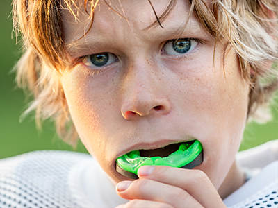 Sports Mouthguards in Simi Valley