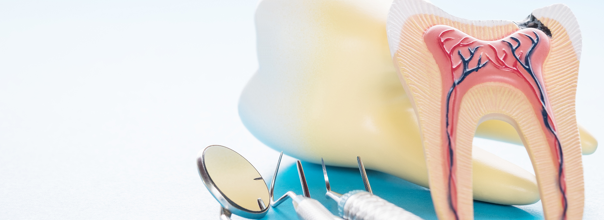 Simi Valley Root Canals