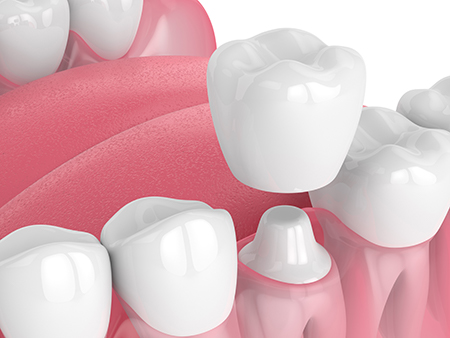 Royal Family Dental